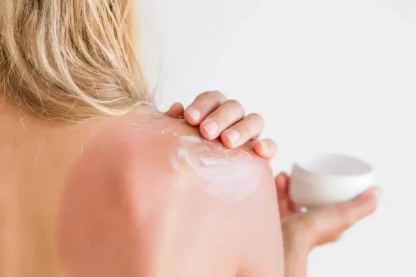 Beneficios del After sun